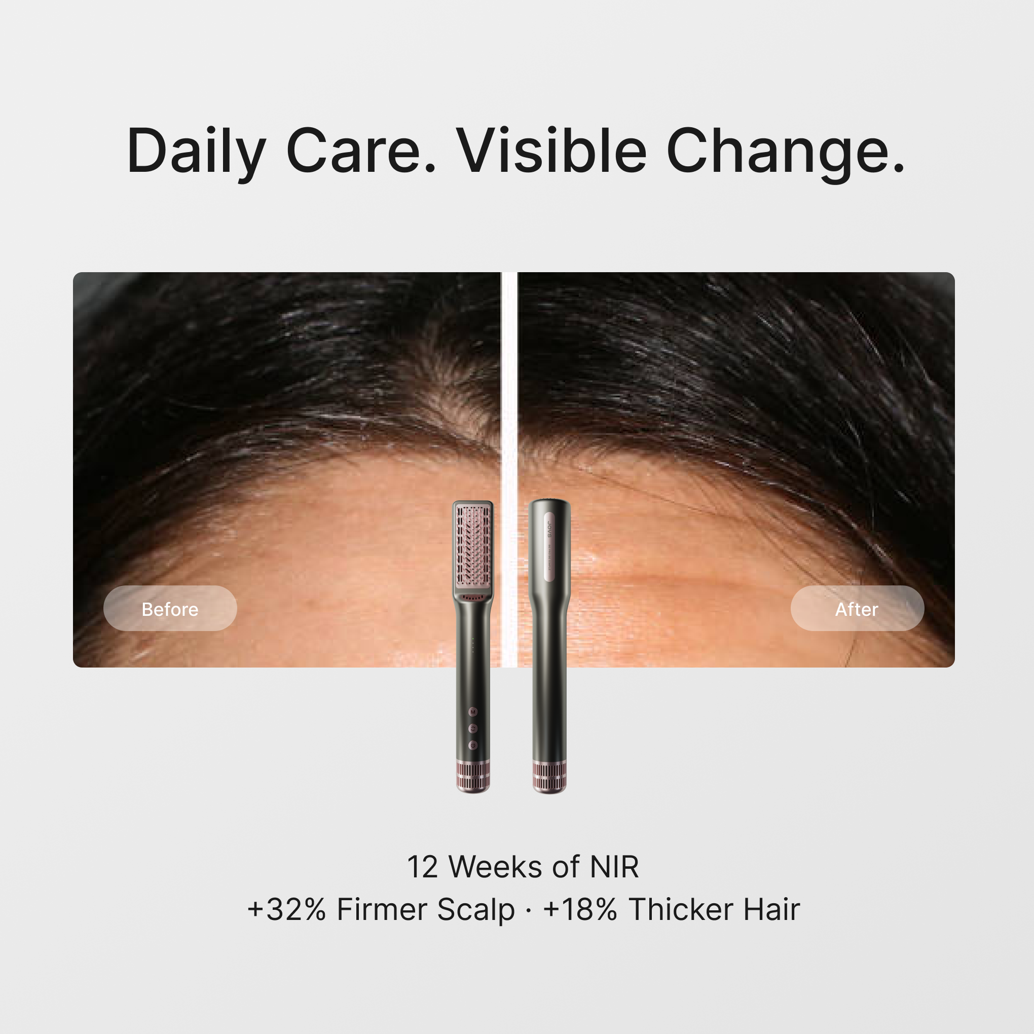 JOVS HLLT Hair Density Dryer