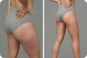 Injury Prevention